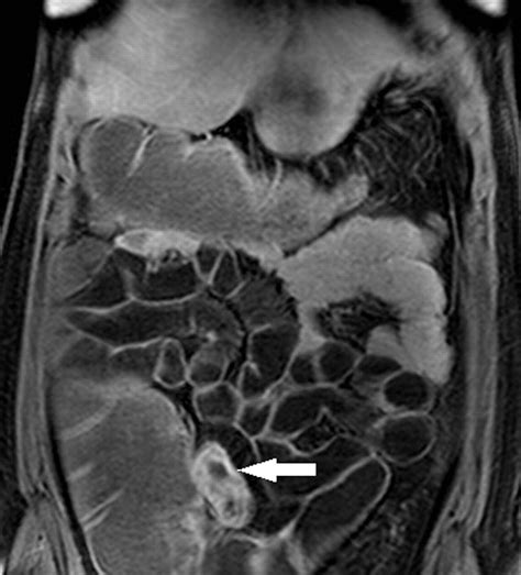 The Future Developments In Gastrointestinal Radiology Frontline