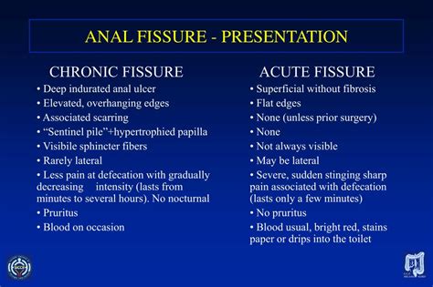 Ppt Treatment Of Anal Fissures Powerpoint Presentation Id 332663