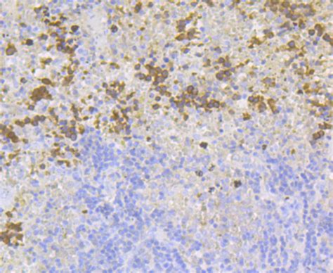 Carbonic Anhydrase I Rabbit Mab Sab Signalway Antibody