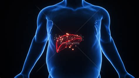 C4d fatty liver scene creative image_picture free download 401860252 ...