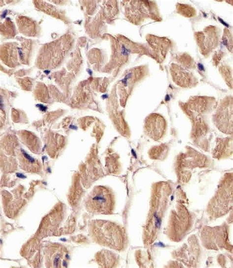 Tuba C Antibody C Term Affinity Purified Rabbit Polyclonal Antibody