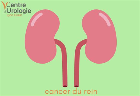 La Tumeur Rénale Le Cancer Du Rein Au 6ème Rang Des Tumeurs Malignes