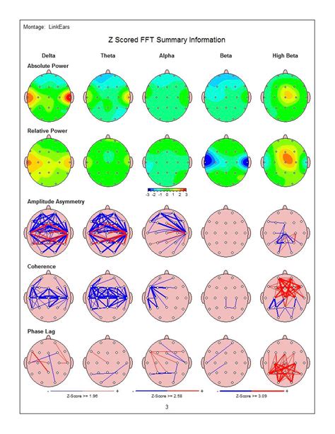 Qeeg Brain Mapping What To Expect And Preparation Checklist