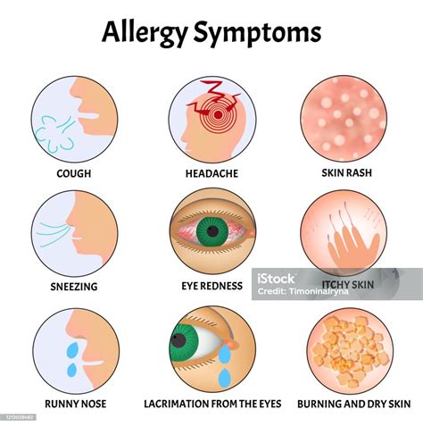 Gejala Alergi Ruam Kulit Kulit Alergi Gatal Robek Dari Mata Batuk Bersin Hidung Meler Sakit ...