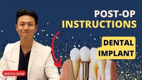 Implant Post Op Instructions Must Watch After Dental Implant Youtube