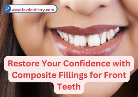 The Ultimate Guide How Long Do Composite Fillings Last On Molars