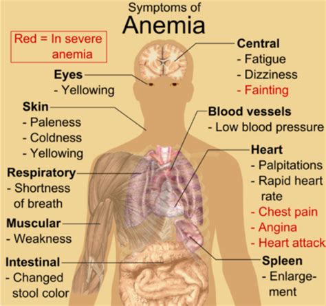 Anemia Flashcards Quizlet