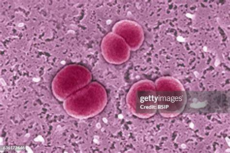 Diplococcus Photos and Premium High Res Pictures - Getty Images