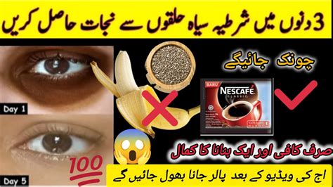 Say Goodbye To Dark Circles 5 Diy Home Remedies Get Rid Of Dark Circles Komal Life Hacks