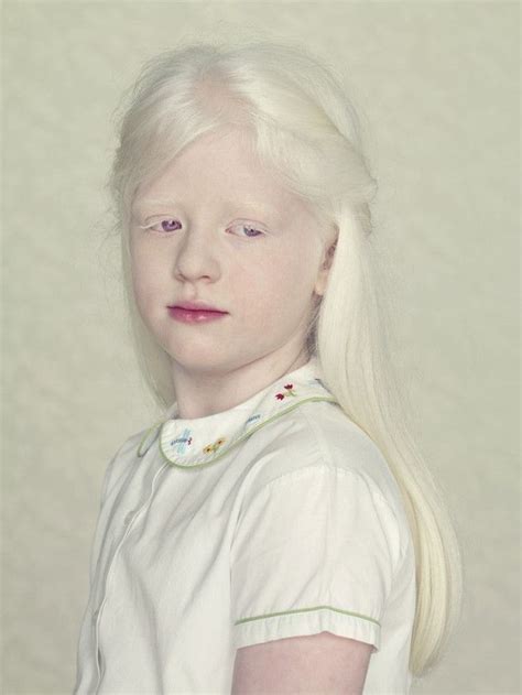 Ethereal Portraits Highlight The Unique Beauty Of A Girl With Albinism And Heterochromia Artofit