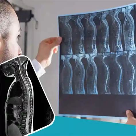 Book MRI Whole Spine Test Price In Delhi Ganesh Diagnostic