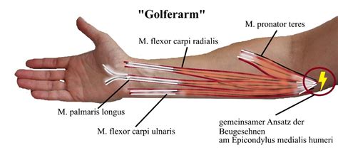 Pathologien Ellenbogen Hand Region 5 See Feel Treats Webseite