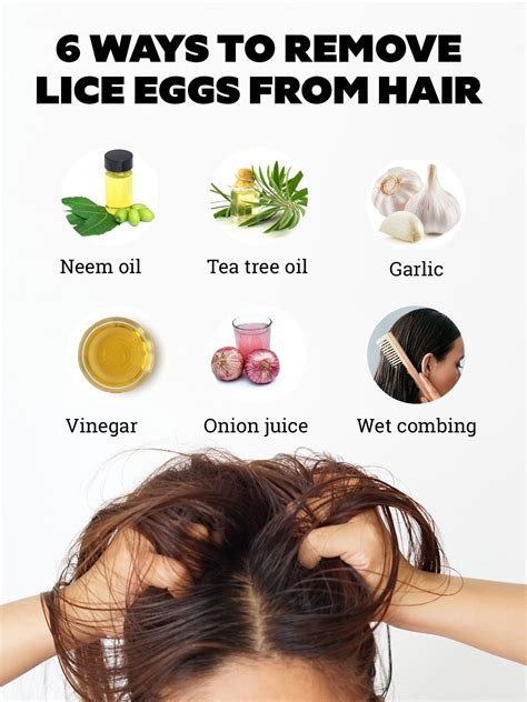 How to remove lice eggs from hair using home remedies – Artofit