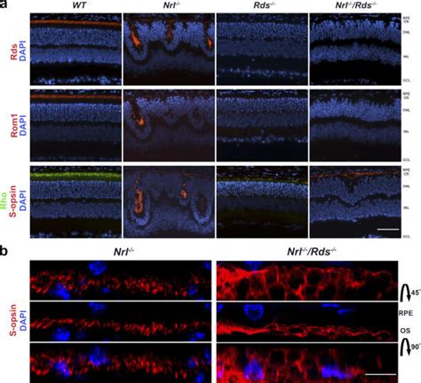 Immunolocalization Of Os Proteins In The Nrl Rds Retina