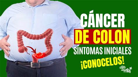 Cancer De Colon Sintomas Comunes