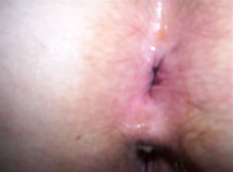 Hungarian Mature Anal Lover Porn Pictures XXX Photos Sex Images PICTOA