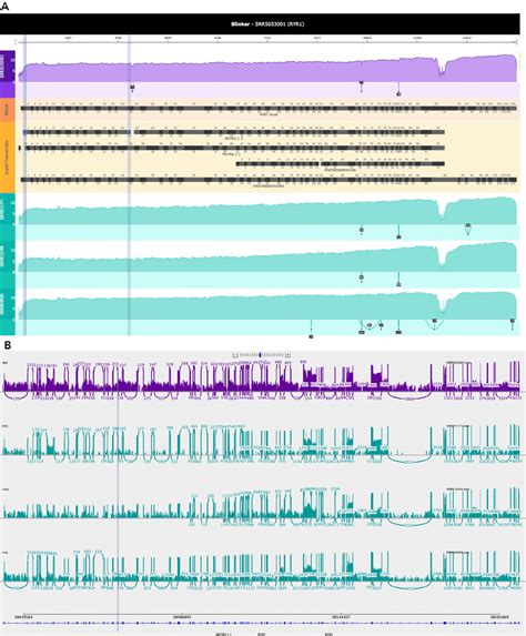 Integrated Genomics Viewer IGV And Slinker Visualisations Of The RYR1