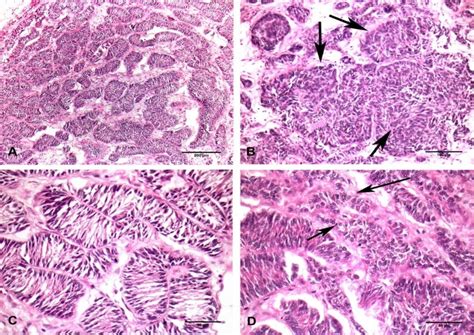 Histopathological Picture Of Sertoli Cell Tumor Isolated From The