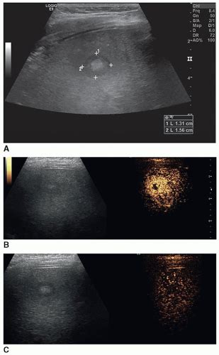 The Pediatric Abdomen Radiology Key