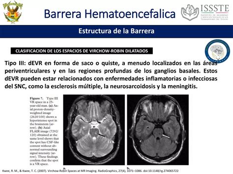 Barrera Hematoencefalica Ppt