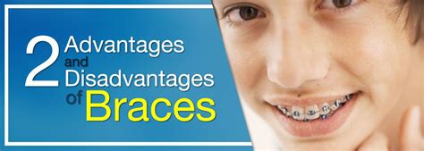 Braces Are One Of The Most Common Methods Of Straightening Misaligned