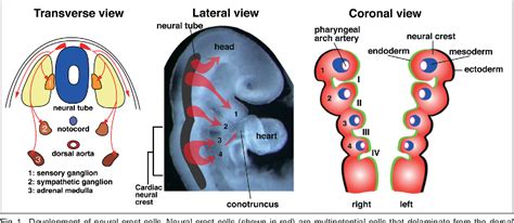 Figure 1 From Cardiac Neural Crest And Congenital Heart Defects