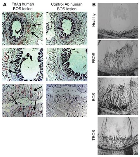 Figure From Role Of Cxcr Cxcr Ligands In Vascular Remodeling