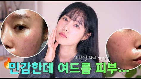 여드름이 있는데 민감하기까지 한 피부😣 민감성 피부 스팟 케어하는 법 스팟케어진정케어 루틴 Youtube