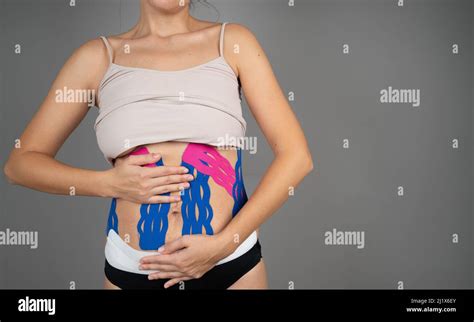 Unknown Woman Shows Her Belly With Physio Tape The Theme Kinesiology