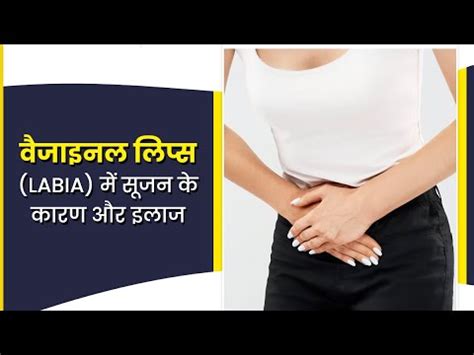 वजइनल लपस म इन करण स ह सकत ह सजन जन इसक इलज Swelling In Vagina Treatment