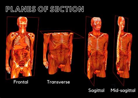 Anatomical Planes