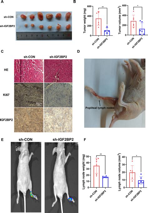 Igf Bp Knockdown Suppressed The Lymphatic Metastasis In Vivo A