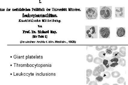 May-Hegglin anomaly. | Download Scientific Diagram