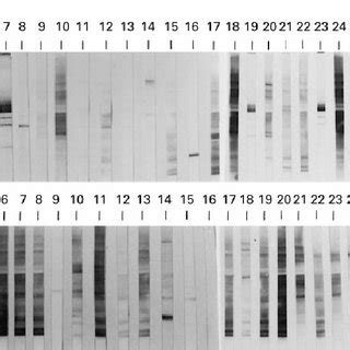 SDS PAGE Immunoblotting A And B Ricinus Communis Pollen Extract