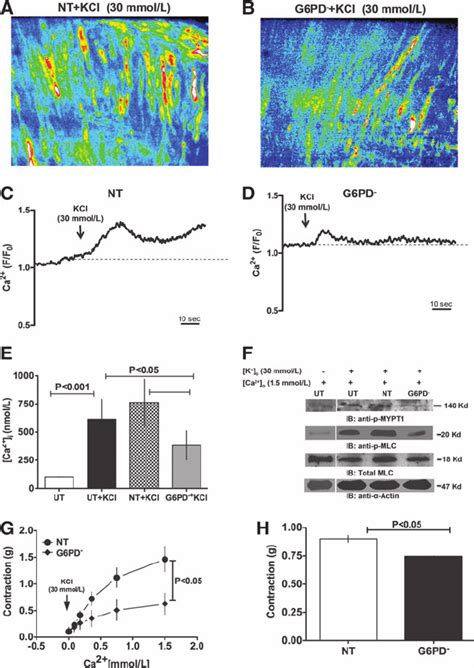 G Pd Knockdown Decreased Kcl Induced Ca Entry Into Ca Smooth