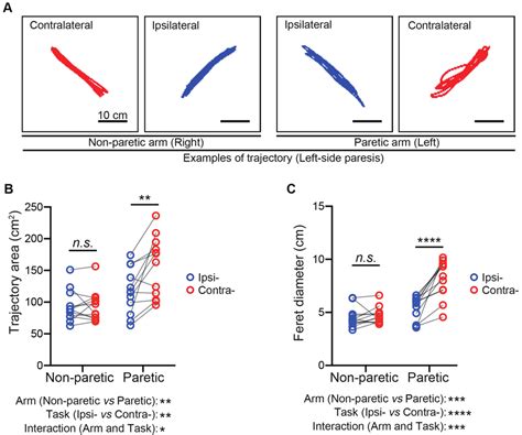 Analysis And Comparison Of The Contralateral And Ipsilateral Diagonal