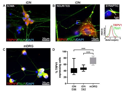 Robust TRPV1 Expression In IDNs A Robust TRPV1 Expression In D36