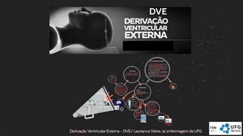 Deriva O Ventricular Externa Dve By Laurianna Vieira On Prezi