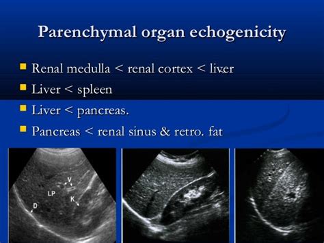 Liver ultrasound