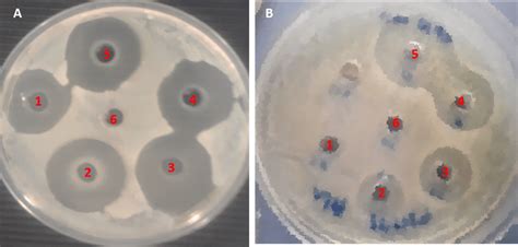 Agar Well Diffusion Plates Showing The Zone Of Inhibition A S