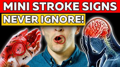 7 Signs Of Mini Strokes In Elderly Transient Ischemic Attack Youtube