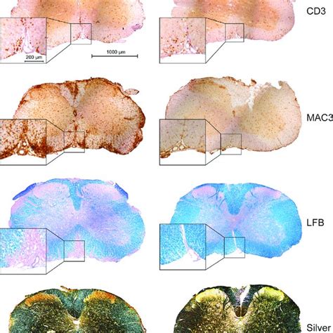 Immunohistochemical And Histological Evaluation Of Neuroinflammation