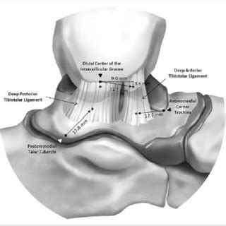 Pdf Anteromedial Ankle Impingement Due To A Talar Cam Lesion And