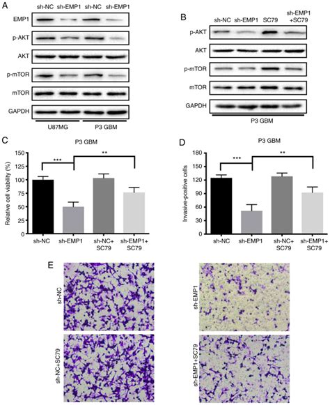 Epithelial Membrane Protein Promotes Glioblastoma Progression Through