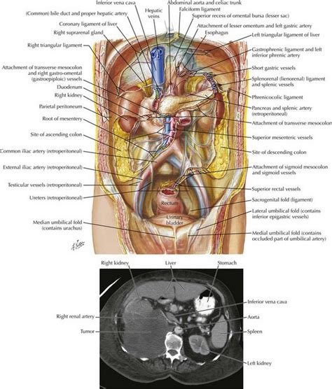 Retroperitoneal Diagram