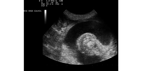 Cross Sectional Ultrasonographic Appearance Of A Jejuno Jejunal Download Scientific Diagram