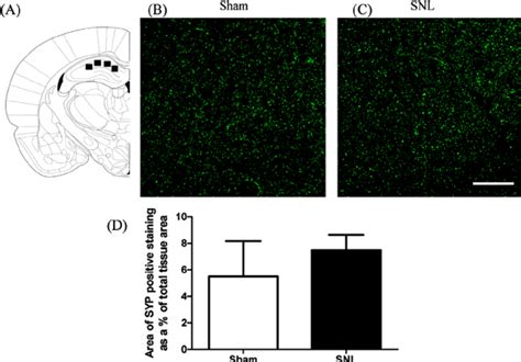 (A) CA1 region of the hippocampus adapted from the Rat Brain Atlas ... 