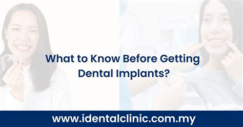 What To Know Before Getting Dental Implants Idental Clinic