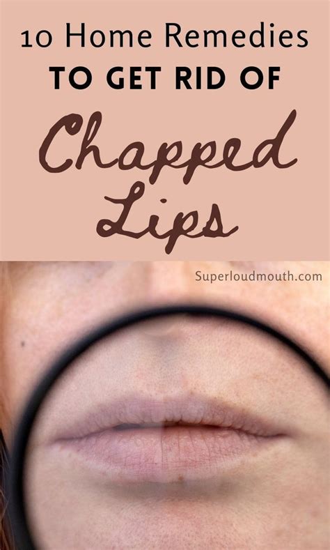 10 Natural Home Remedies For Chapped And Dehydrated Lips Artofit