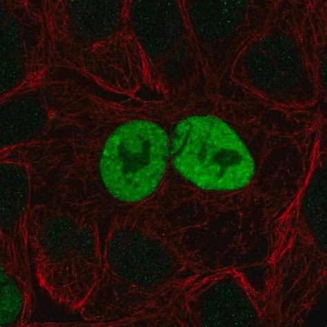 Anti Cdkn A Antibody Produced In Rabbit